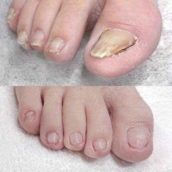 Tagasiside Keramiini kasutamisest